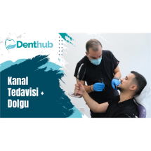 İstanbul Denthub   Kanal tedavisi + Dolgu